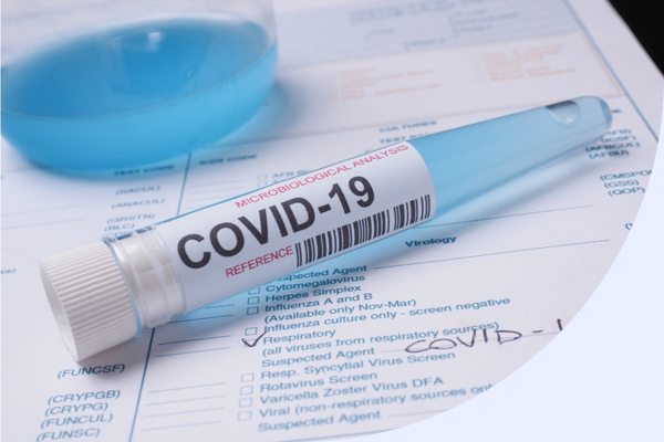 Covid-19 and media advertising: How to limit the damage?